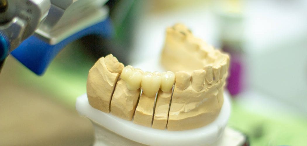 protesi dentaria